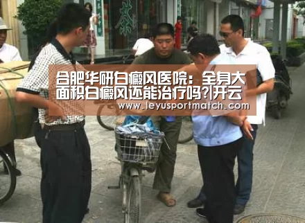 合肥华研白癜风医院:全身大面积白癜风还能治疗吗?|开云乐鱼(图2) 合肥华研白癜风医院:全身大面积白癜风还能治疗吗?|开云乐鱼(图2)